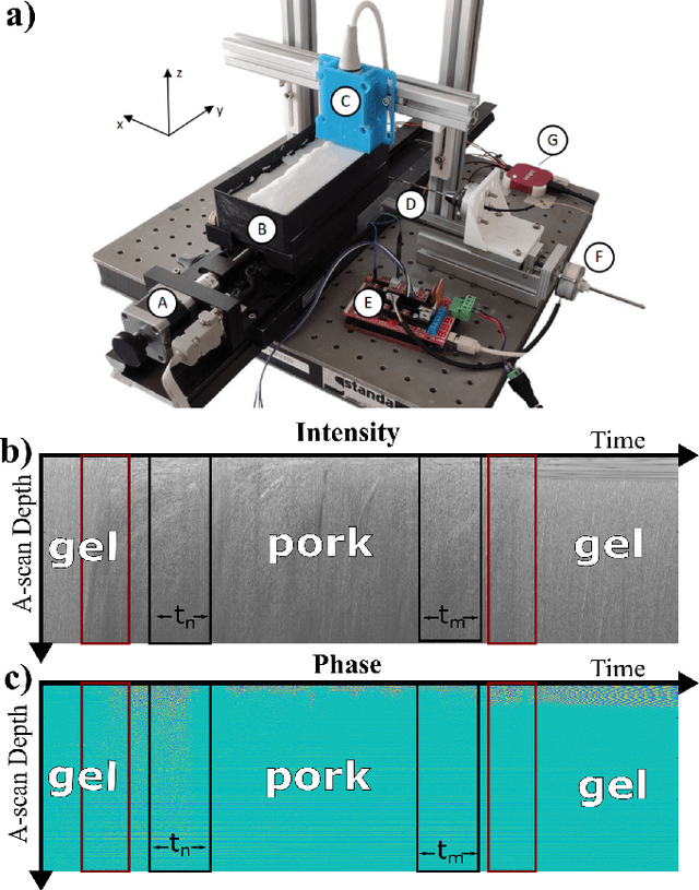 Figure 1 for Tissue Classification During Needle Insertion Using Self-Supervised Contrastive Learning and Optical Coherence Tomography