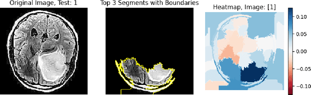Figure 2 for Enhancing Deep Learning Model Explainability in Brain Tumor Datasets using Post-Heuristic Approaches