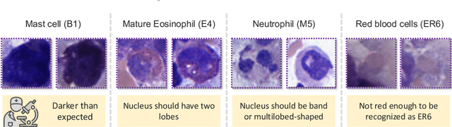 Figure 2 for Aligning Synthetic Medical Images with Clinical Knowledge using Human Feedback