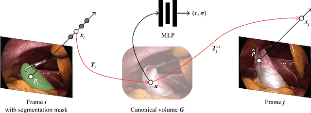 Figure 1 for Neural Fields for 3D Tracking of Anatomy and Surgical Instruments in Monocular Laparoscopic Video Clips