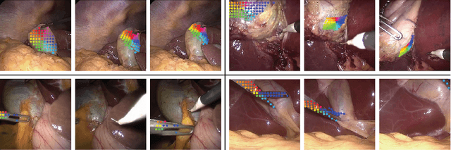 Figure 3 for Neural Fields for 3D Tracking of Anatomy and Surgical Instruments in Monocular Laparoscopic Video Clips