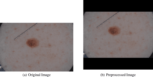 Figure 3 for Cancer-Net SCa-Synth: An Open Access Synthetically Generated 2D Skin Lesion Dataset for Skin Cancer Classification