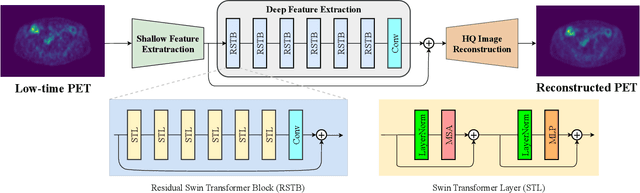 Figure 4 for Whole-body PET image denoising for reduced acquisition time