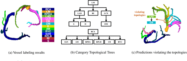 Figure 1 for Topology-Preserving Automatic Labeling of Coronary Arteries via Anatomy-aware Connection Classifier