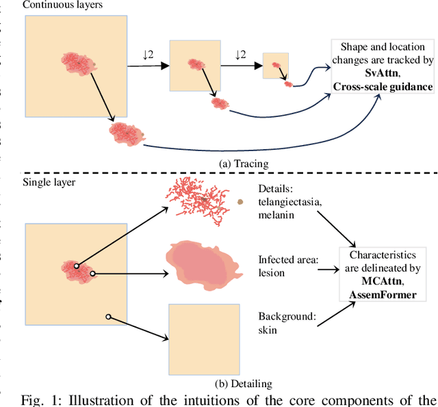 Figure 1 for SvANet: A Scale-variant Attention-based Network for Small Medical Object Segmentation