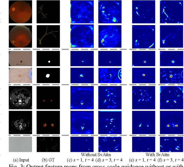 Figure 3 for SvANet: A Scale-variant Attention-based Network for Small Medical Object Segmentation