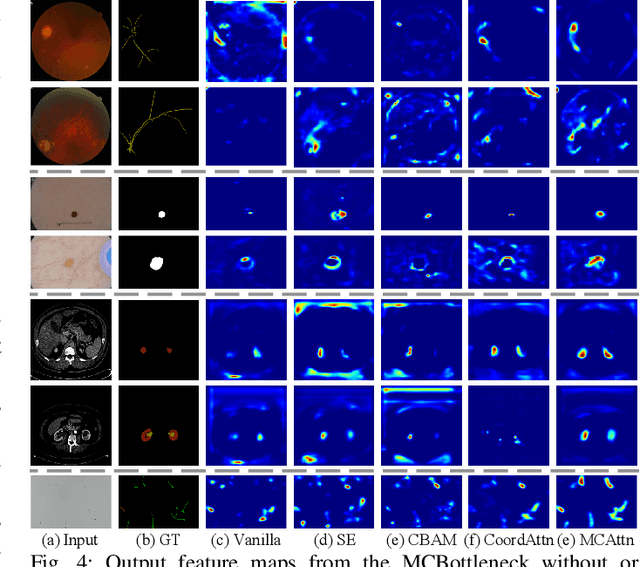 Figure 4 for SvANet: A Scale-variant Attention-based Network for Small Medical Object Segmentation