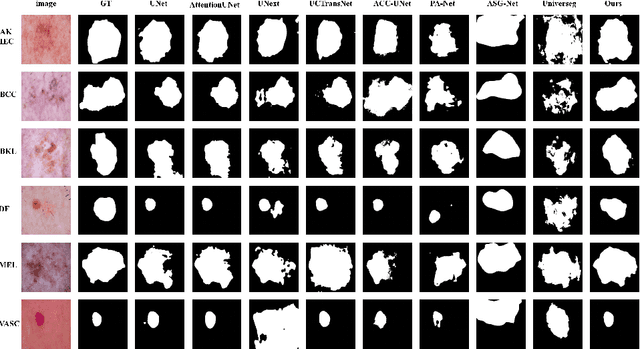 Figure 3 for MatchSeg: Towards Better Segmentation via Reference Image Matching