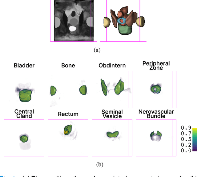 Figure 4 for Semi-weakly-supervised neural network training for medical image registration