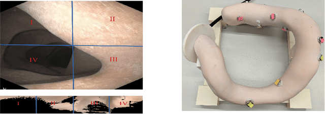 Figure 4 for ColNav: Real-Time Colon Navigation for Colonoscopy