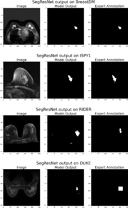 Figure 1 for BC-MRI-SEG: A Breast Cancer MRI Tumor Segmentation Benchmark