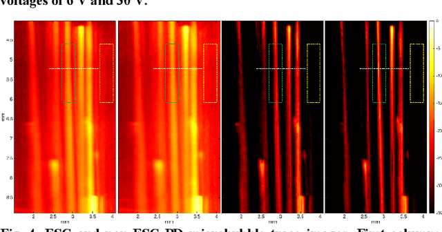 Figure 4 for High-resolution Power Doppler Using Null Subtraction Imaging