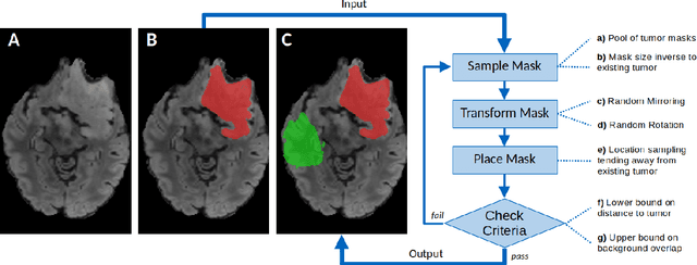 Figure 4 for The Brain Tumor Segmentation  Challenge 2023: Local Synthesis of Healthy Brain Tissue via Inpainting