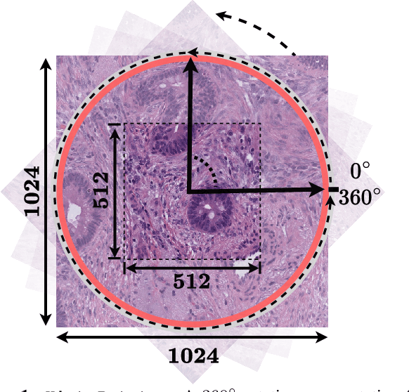 Figure 1 for Rotation-Agnostic Image Representation Learning for Digital Pathology