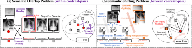 Figure 2 for Knowledge Boosting: Rethinking Medical Contrastive Vision-Language Pre-Training