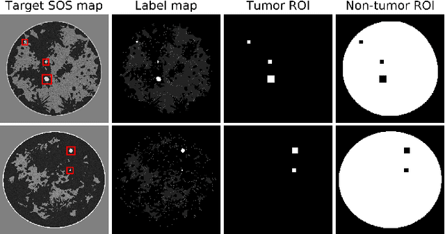 Figure 1 for Investigating the Use of Traveltime and Reflection Tomography for Deep Learning-Based Sound-Speed Estimation in Ultrasound Computed Tomography