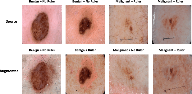 Figure 3 for MaskMedPaint: Masked Medical Image Inpainting with Diffusion Models for Mitigation of Spurious Correlations