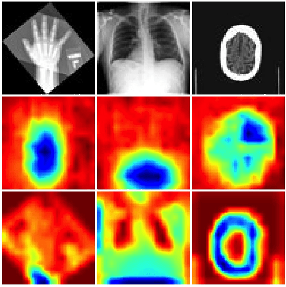 Figure 4 for MONAI: An open-source framework for deep learning in healthcare