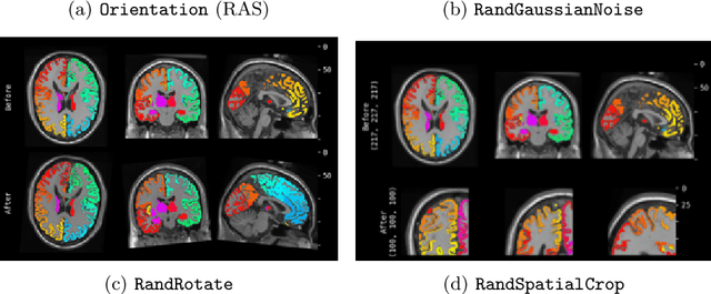 Figure 3 for MONAI: An open-source framework for deep learning in healthcare