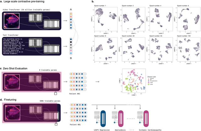 Figure 1 for A Generalizable Deep Learning System for Cardiac MRI