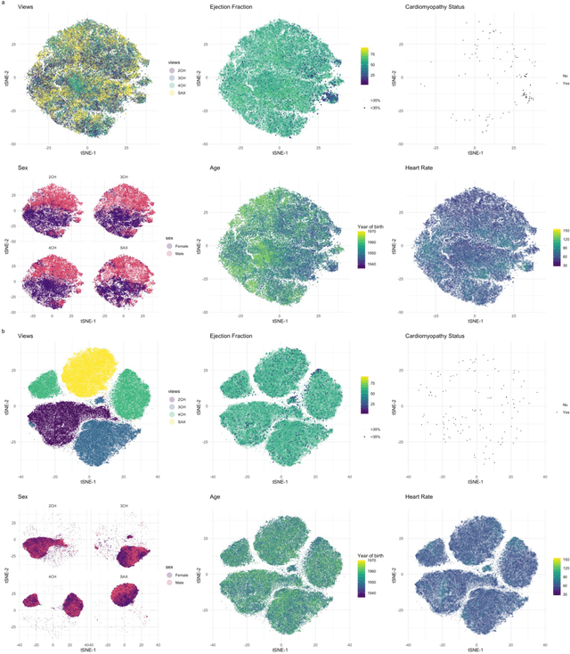 Figure 2 for A Generalizable Deep Learning System for Cardiac MRI