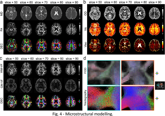 Figure 1 for Diff5T: Benchmarking Human Brain Diffusion MRI with an Extensive 5.0 Tesla K-Space and Spatial Dataset