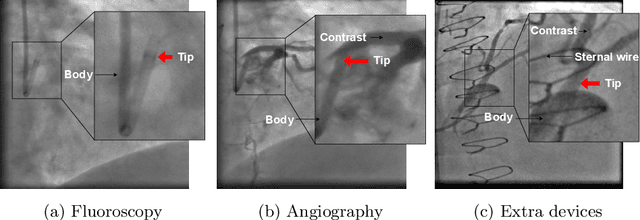 Figure 1 for ConTrack: Contextual Transformer for Device Tracking in X-ray