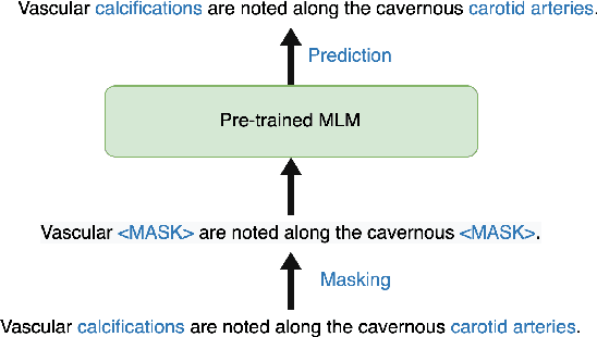 Figure 1 for RadBARTsum: Domain Specific Adaption of Denoising Sequence-to-Sequence Models for Abstractive Radiology Report Summarization