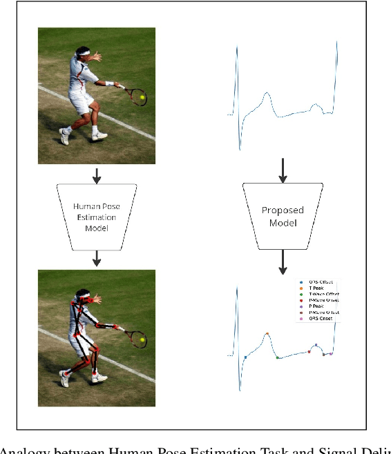 Figure 1 for An Efficient and Flexible Deep Learning Method for Signal Delineation via Keypoints Estimation