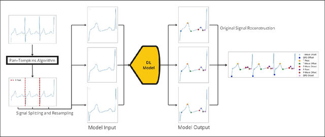 Figure 2 for An Efficient and Flexible Deep Learning Method for Signal Delineation via Keypoints Estimation