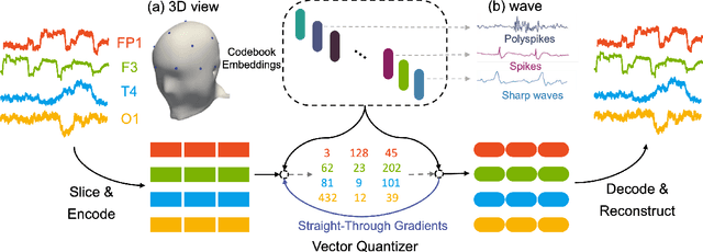 Figure 1 for EEGFormer: Towards Transferable and Interpretable Large-Scale EEG Foundation Model