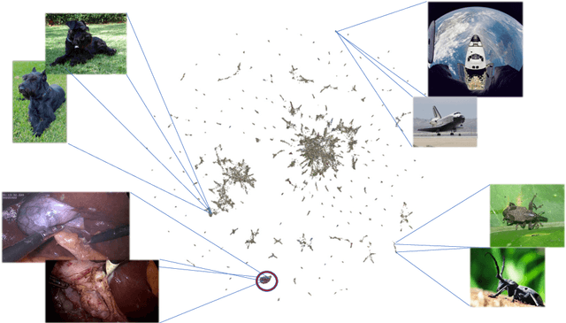 Figure 1 for Jumpstarting Surgical Computer Vision