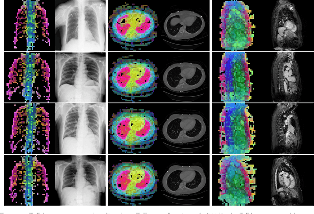 Figure 3 for Towards General Purpose Vision Foundation Models for Medical Image Analysis: An Experimental Study of DINOv2 on Radiology Benchmarks