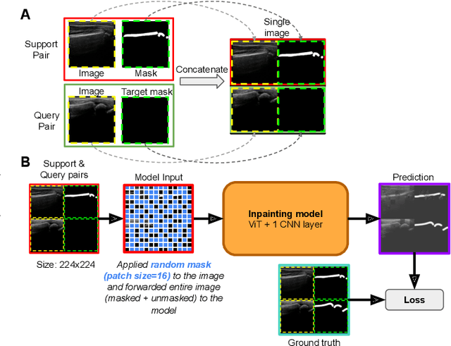 Figure 1 for A Simple Framework Uniting Visual In-context Learning with Masked Image Modeling to Improve Ultrasound Segmentation