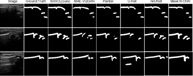 Figure 2 for A Simple Framework Uniting Visual In-context Learning with Masked Image Modeling to Improve Ultrasound Segmentation