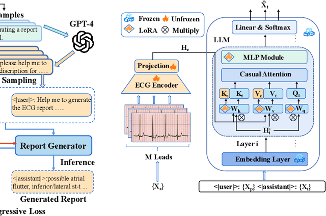 Figure 3 for Electrocardiogram Instruction Tuning for Report Generation