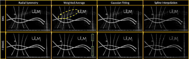 Figure 2 for A Performance Evaluation of Filtered Delay Multiply and Sum Beamforming for Ultrasound Localization Microscopy: Preliminary Results
