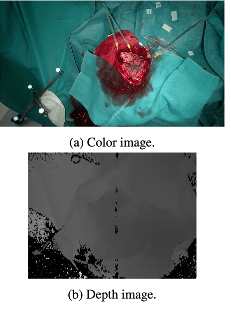 Figure 4 for SLIMBRAIN: Augmented Reality Real-Time Acquisition and Processing System For Hyperspectral Classification Mapping with Depth Information for In-Vivo Surgical Procedures