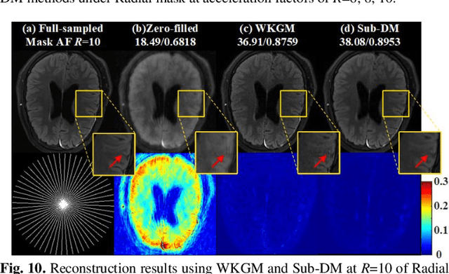 Figure 2 for Sub-DM:Subspace Diffusion Model with Orthogonal Decomposition for MRI Reconstruction