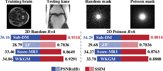 Figure 3 for Sub-DM:Subspace Diffusion Model with Orthogonal Decomposition for MRI Reconstruction