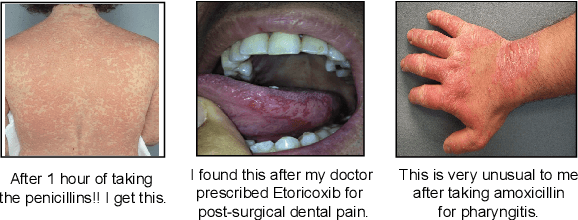 Figure 1 for Enhancing Adverse Drug Event Detection with Multimodal Dataset: Corpus Creation and Model Development