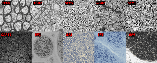 Figure 1 for Multi-Domain Data Aggregation for Axon and Myelin Segmentation in Histology Images