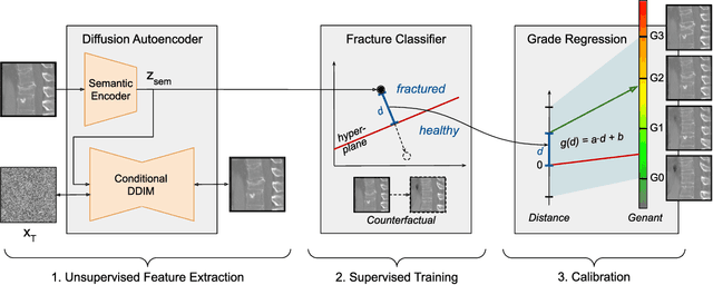 Figure 1 for Counterfactual Explanations for Medical Image Classification and Regression using Diffusion Autoencoder