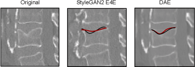 Figure 3 for Counterfactual Explanations for Medical Image Classification and Regression using Diffusion Autoencoder