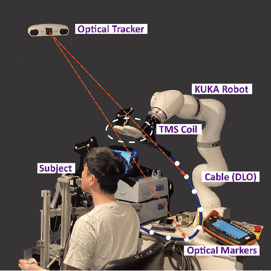 Figure 1 for Realtime Robust Shape Estimation of Deformable Linear Object