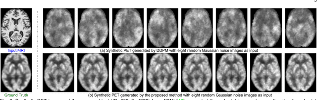 Figure 3 for Functional Imaging Constrained Diffusion for Brain PET Synthesis from Structural MRI