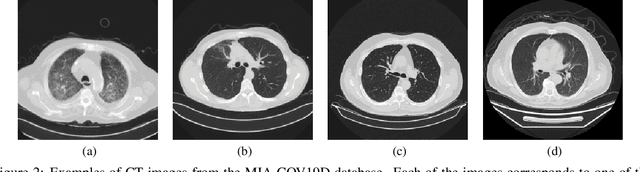 Figure 3 for MIA-3DCNN: COVID-19 Detection Based on a 3D CNN