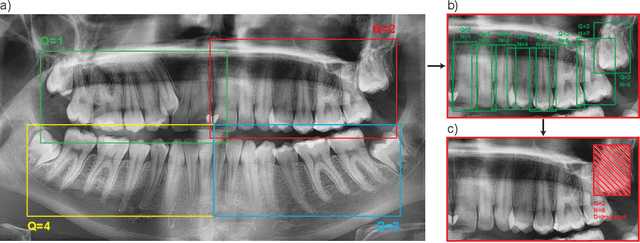 Figure 1 for Diffusion-Based Hierarchical Multi-Label Object Detection to Analyze Panoramic Dental X-rays