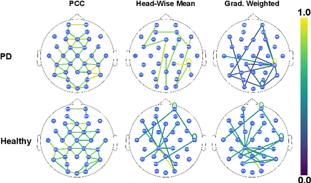 Figure 3 for Parkinson's Disease Detection from Resting State EEG using Multi-Head Graph Structure Learning with Gradient Weighted Graph Attention Explanations