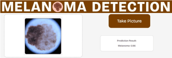 Figure 3 for Melanoma Detection with Uncertainty Quantification